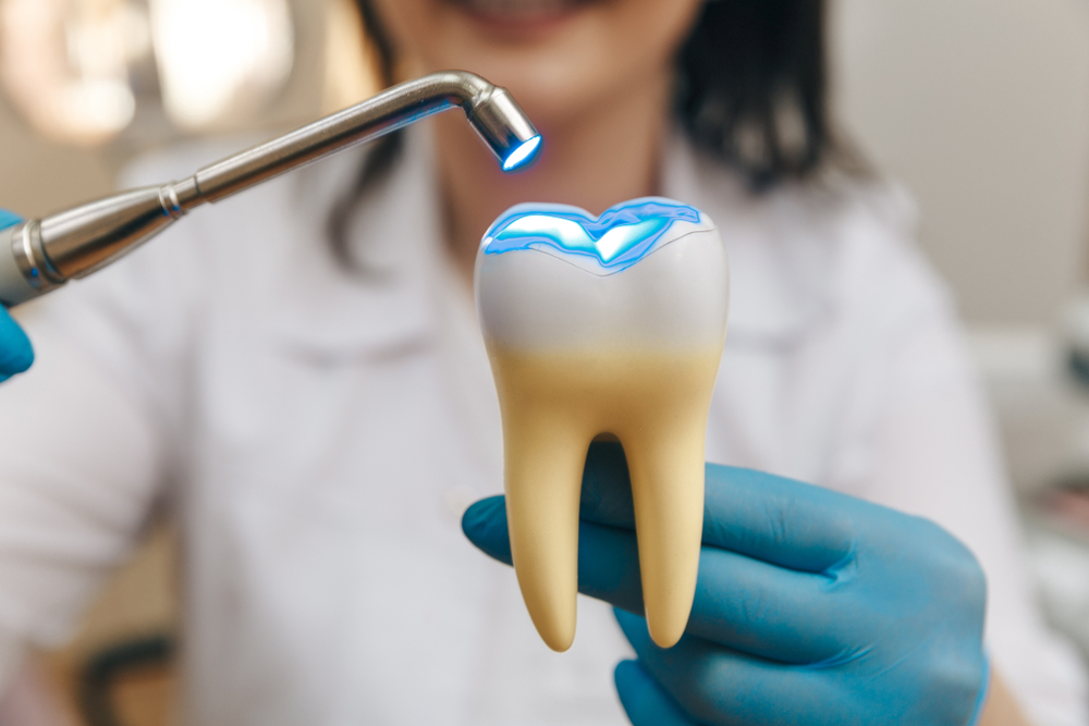 What are the Benefits of Tooth Colored Fillings? Watertown MN