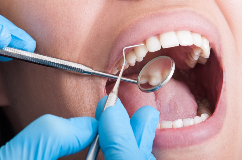 Teeth Cleaning Near Me in Watertown