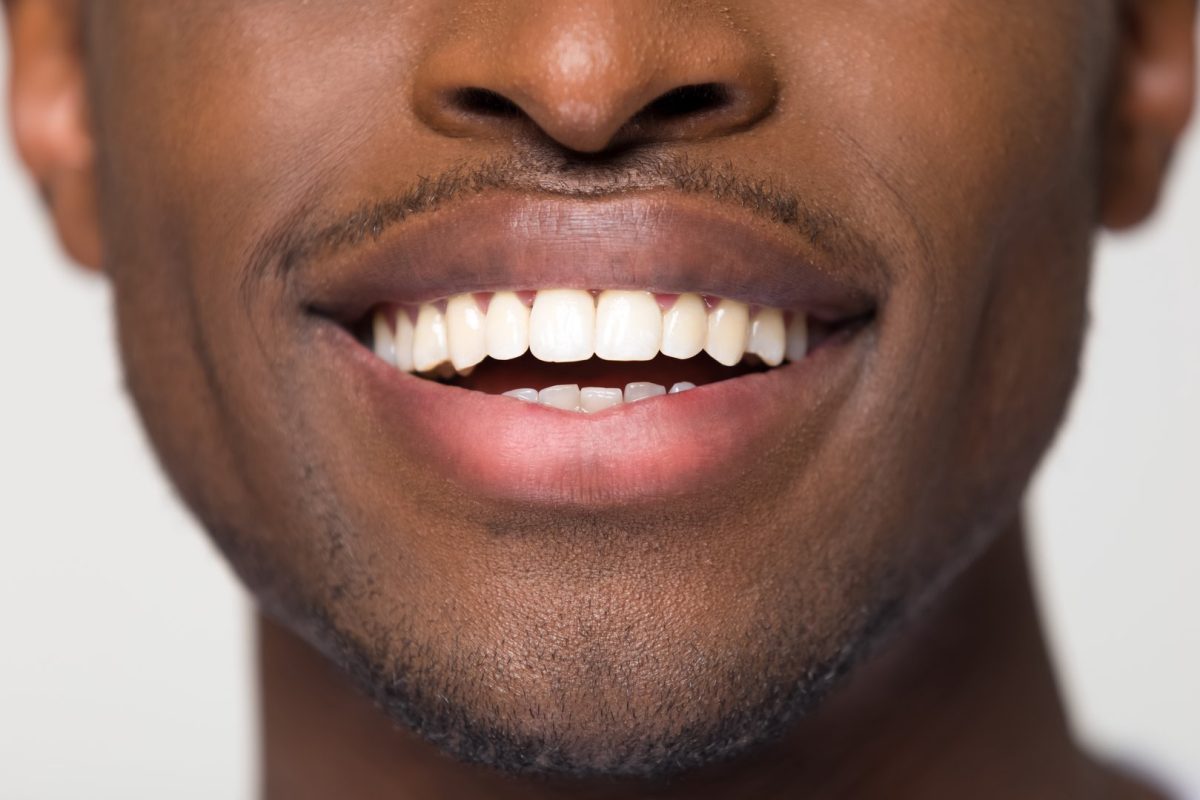 Best Dentist Near Me in Watertown, MN