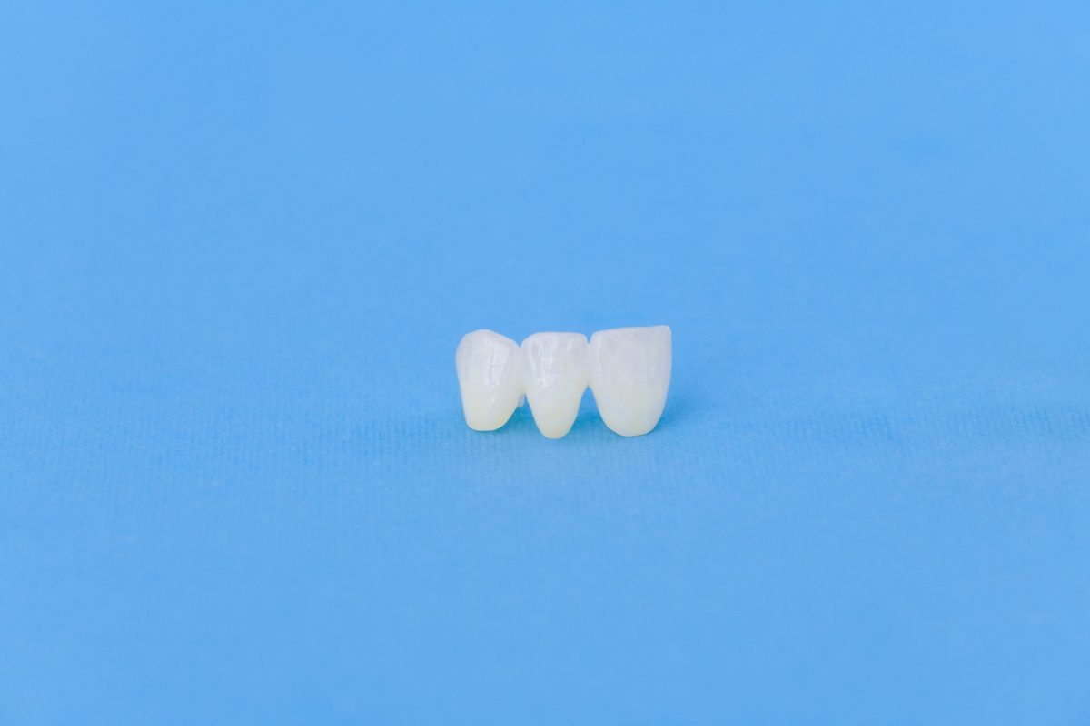 Why Are Dental Crowns Important, and Which Dentist Can Treat Me
